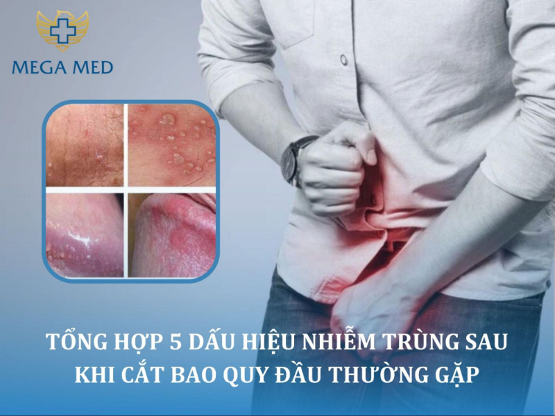Dấu hiệu nhiễm trùng sau khi cắt bao quy đầu